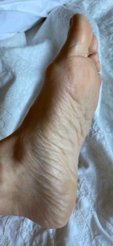 Customer photo review of LOVASKIN INSTANT FOOT PEEL Deluxe Kit - 25 Beauty treatments