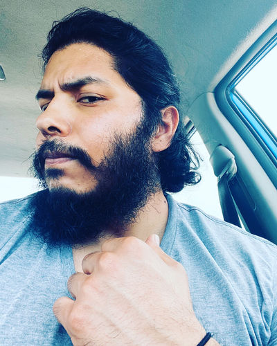 Customer photo review of 12.5% Minoxidil Extra Strength Topical Solution USP for Men.