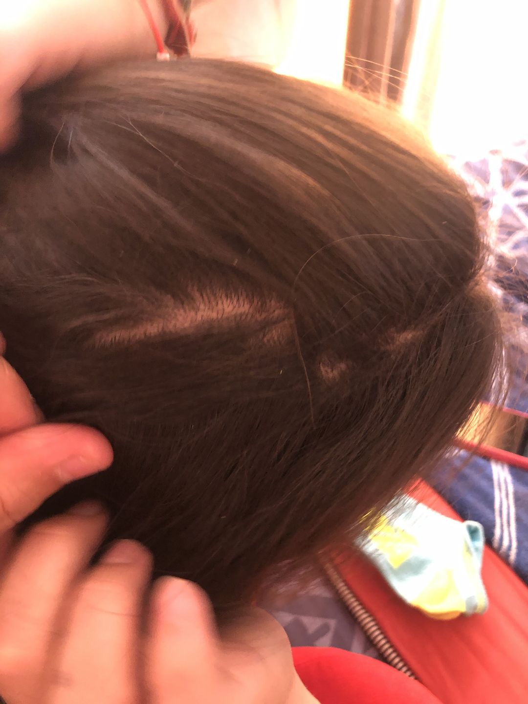 Customer photo review of SHAMPOO ANTICASPA GRASA FORMATO BARRA