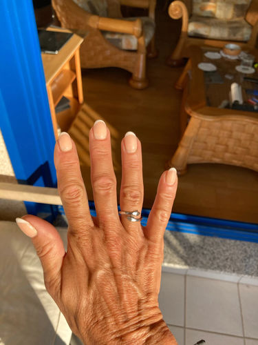 Customer photo review of Hug Ring