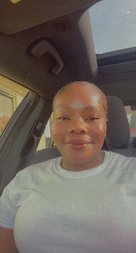 Customer photo review of BERRI-CLEAR+ 5 BERRY SUPERFRUIT SERUM