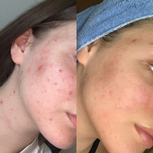 Customer photo review of GLOW DUOs