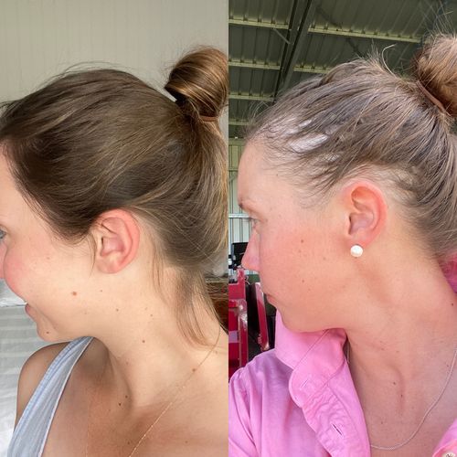 Customer photo review of Hair Growth With Argan Oil - 10 Minute Miracle - Spray Bundle