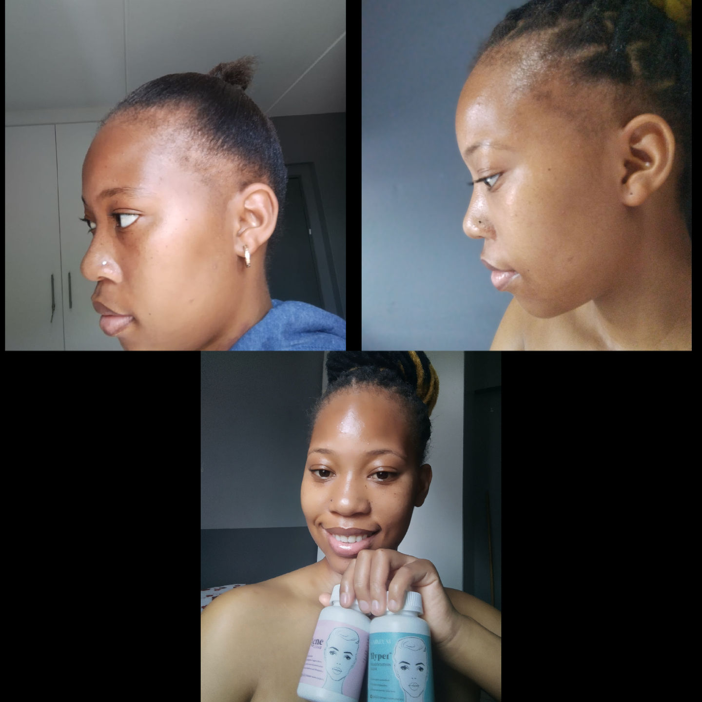 Customer photo review of Gmaeum Clear Complexion Set