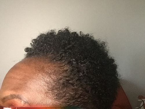 Customer photo review of Luxe Box Growth Bundle Pre-Sale Item Will Ship in 10-12 Weeks
