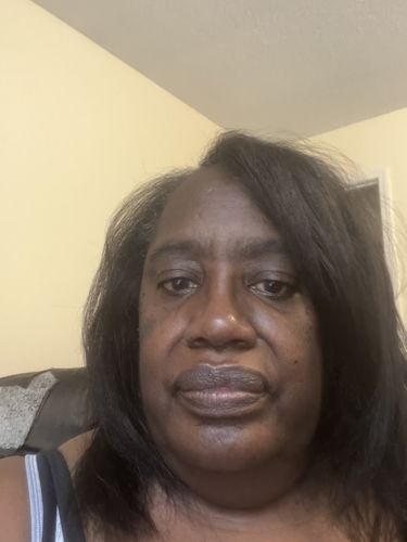 Customer photo review of APPY HOUR: Rapid Growth Hair Grease