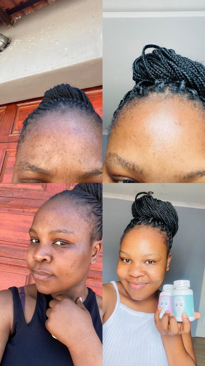 Customer photo review of Gmaeum Clear Complexion Set