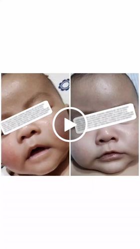 Customer video review of Jolicare Cream