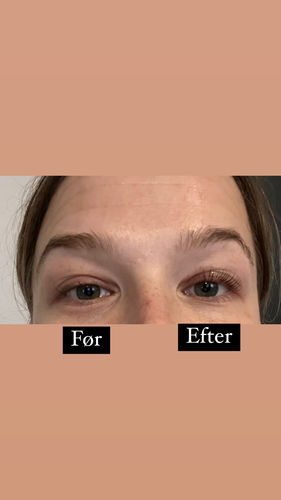 Customer photo review of SimplyLash kit