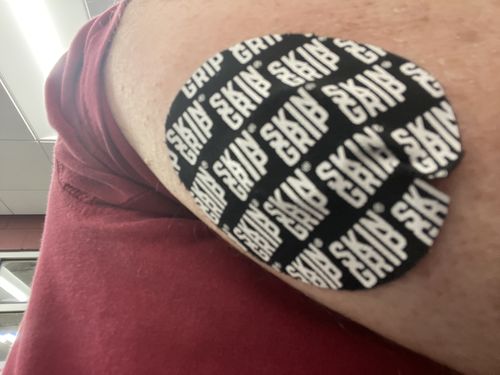 Customer photo review of Skin Grip Original - Freestyle Libre Adhesive Patches