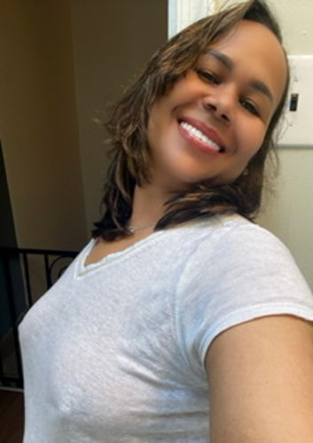 Customer photo review of WrinkleFix: Botox (Existing Customers)