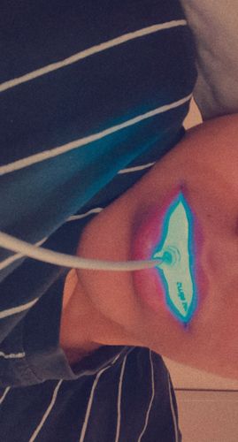 Customer photo review of GRATIS Travel Bundle