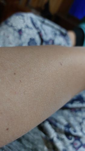 Customer photo review of Depilador Nuva Skin®