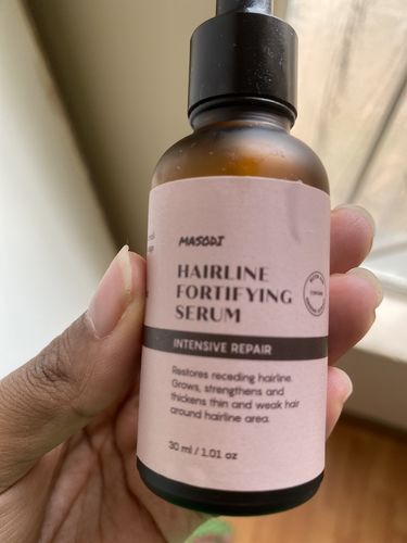 Customer photo review of Hairline Fortifying Serum 30ml