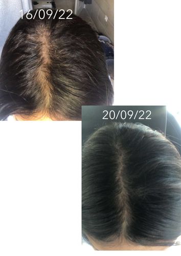 Customer photo review of Good Hair Vitamins Pousse et fortification - 1 mois