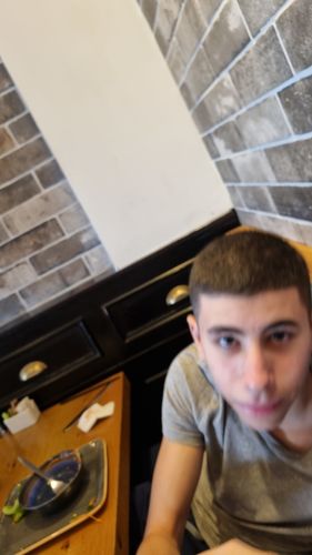 Customer photo review of ערכה טיפולית לעור שמן ופצעונים | AC - CLEAR CONTROL KIT