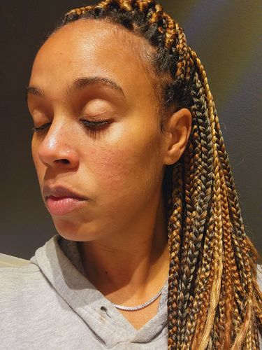 Customer photo review of Turmeric Soap