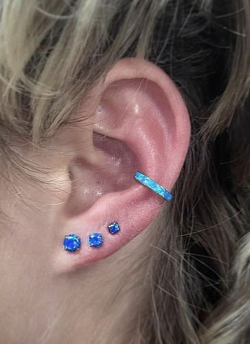 Customer photo review of Opal Value Pack