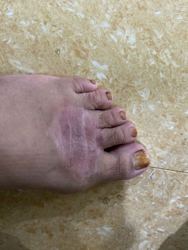 Customer photo review of Jolicare Cream