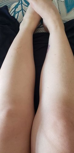 Customer photo review of Depilador Nuva Skin®