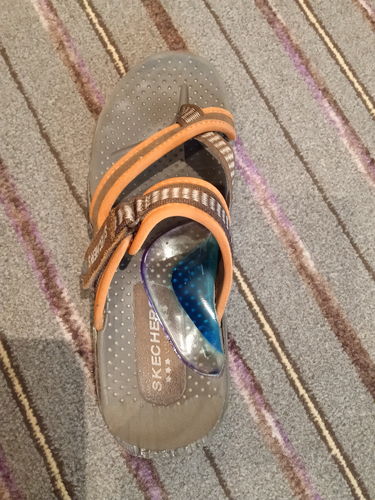 Customer photo review of Metatarsal Silicone Cushion Support | Provides Support to the Metatarsals to Relieve Pain (Beige)