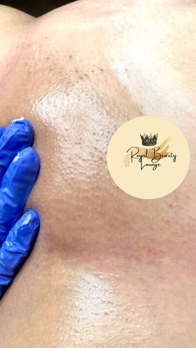 Customer photo review of Signature Series Hair Removal Wax