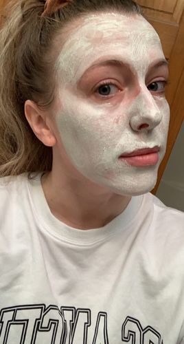 Customer photo review of Masque de nettoyage en profondeur sans pores