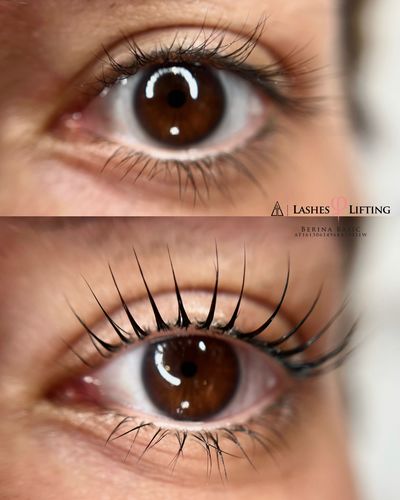 Customer photo review of HIGHLASH® Wimpern und Augenbrauen Serum