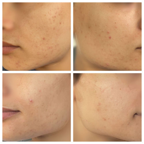 Customer photo review of Decalt