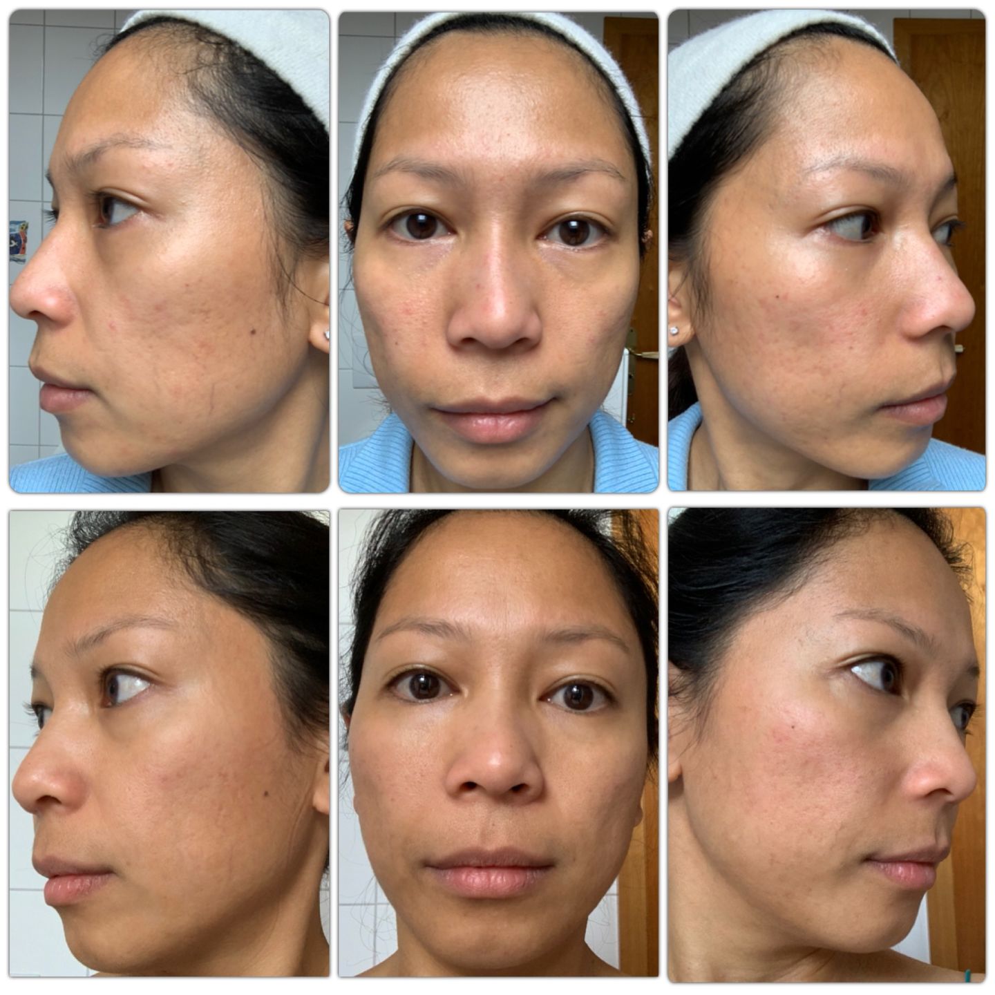 Customer photo review of Advanced Repair
