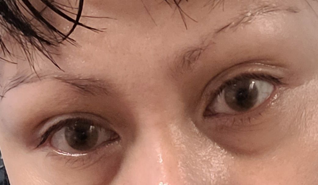 Customer photo review of Hidrocor AVELA Brown Prescription Colored Contact Lenses