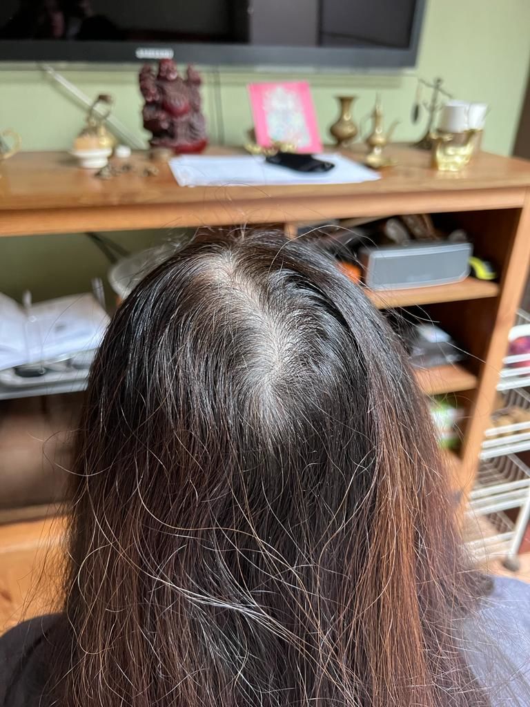 Customer photo review of Shampoo Anticaída 250ml