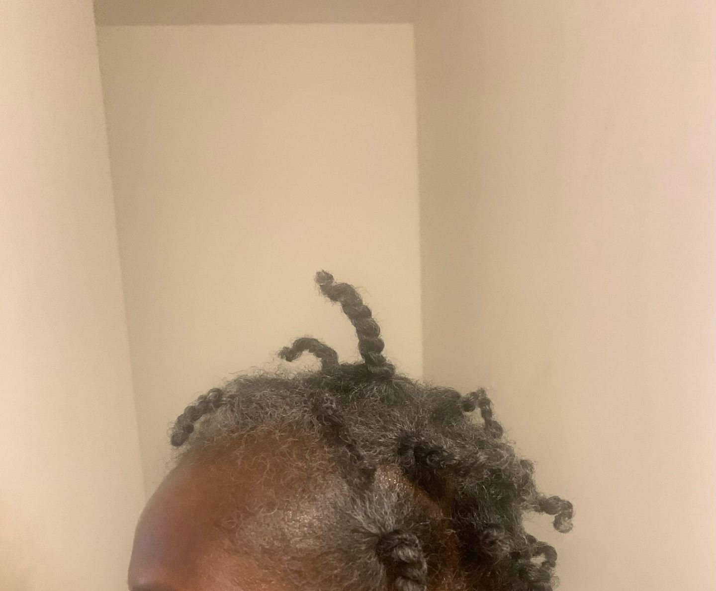 Customer photo review of Hair Recovery Bundle