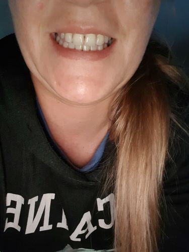 Customer photo review of PAP+ Complete Set