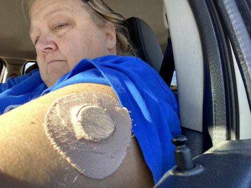 Customer photo review of Skin Grip Original - Freestyle Libre Adhesive Patches