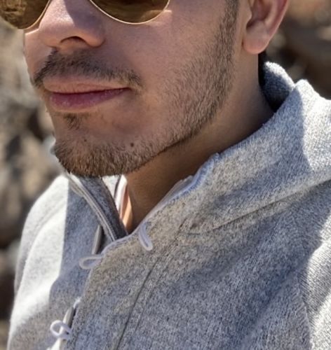 Customer photo review of Kit de Crecimiento de Barba y Bigote Bálsamo Minoxidil 14% + 1 Aceite Premium