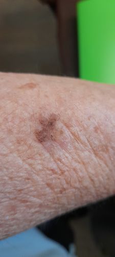 Customer photo review of MAGNESIUM SUPER STICK