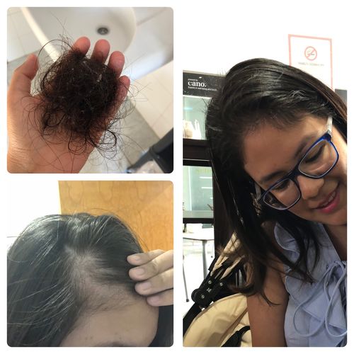 Customer photo review of Suero Anti Caída