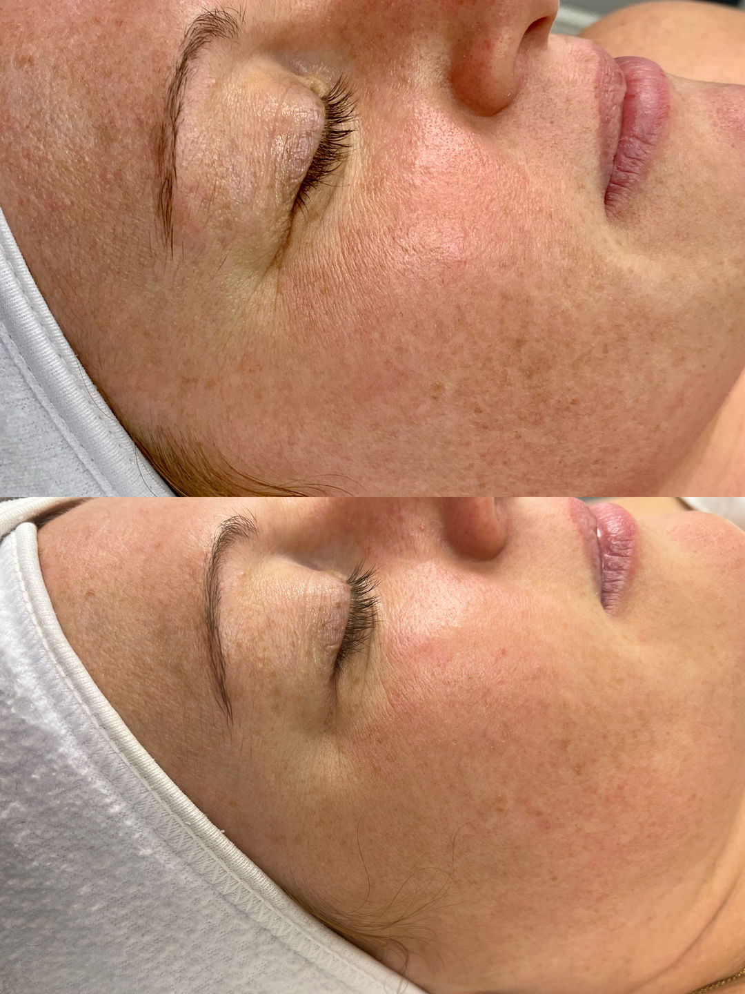 Customer photo review of Zena 100% Organic Algae Peel