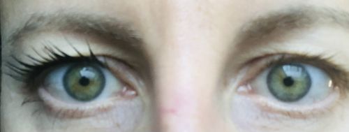 Customer photo review of HIGHLASH® Lash Boosting Duo