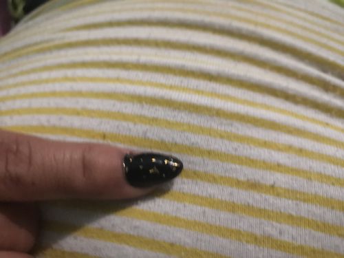 Customer photo review of Gel Efecto Hoja Oro 24K 15 ml Fantasy Nails