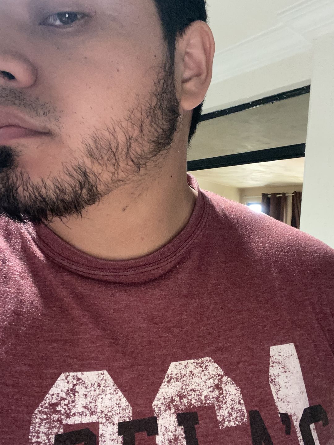 Customer photo review of Kit Adiós Alopecia