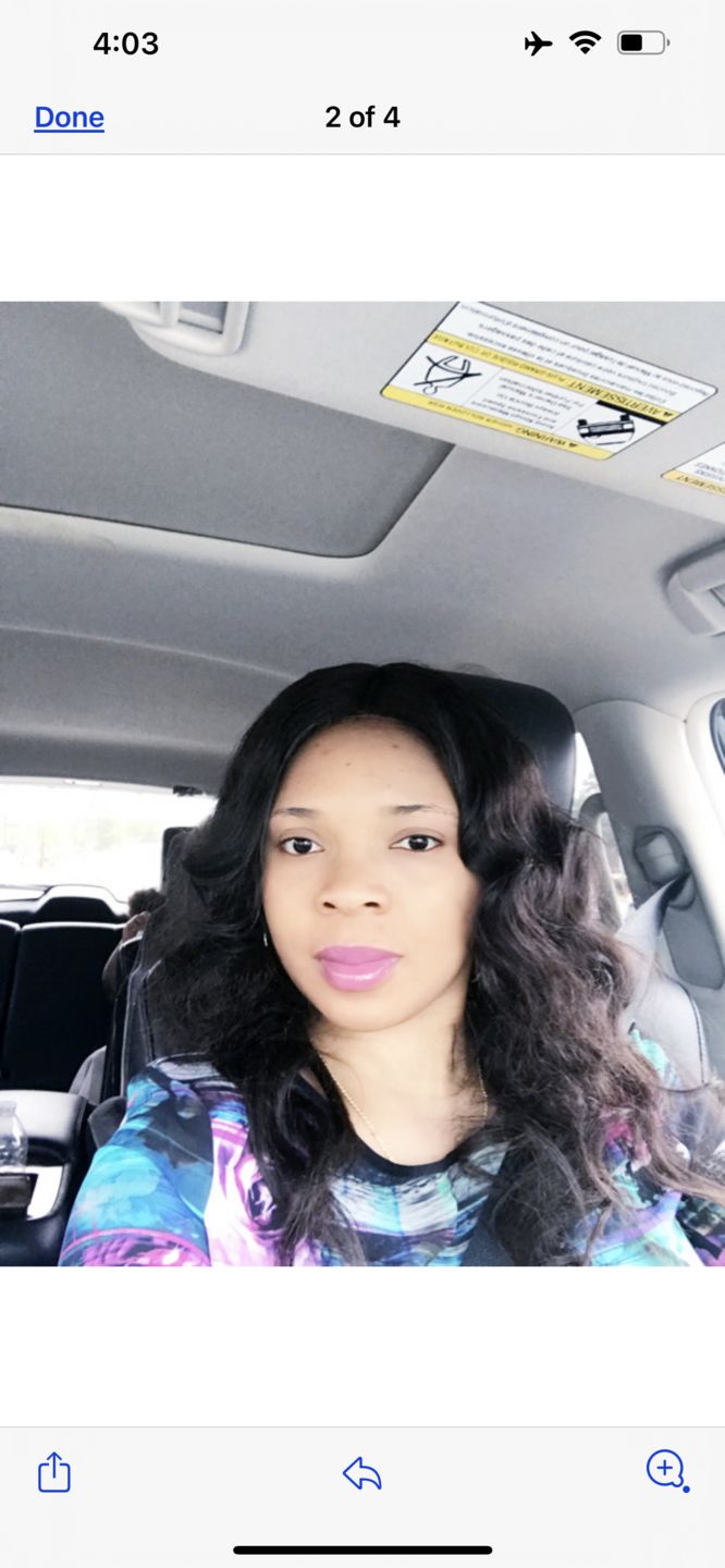 Customer photo review of Fair and White Glutathion Extra Serum Anti-Dark Spot 30ml / 1.01 Fl Oz