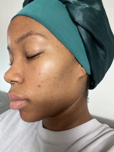Customer photo review of GLOW DUOs