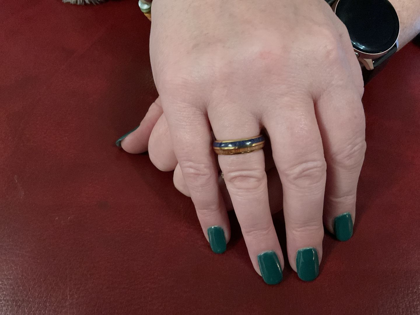 Customer photo review of The Golden Blue 6mm Wonder Ring