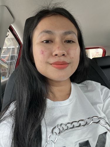 Customer photo review of Instant Pore Eraser