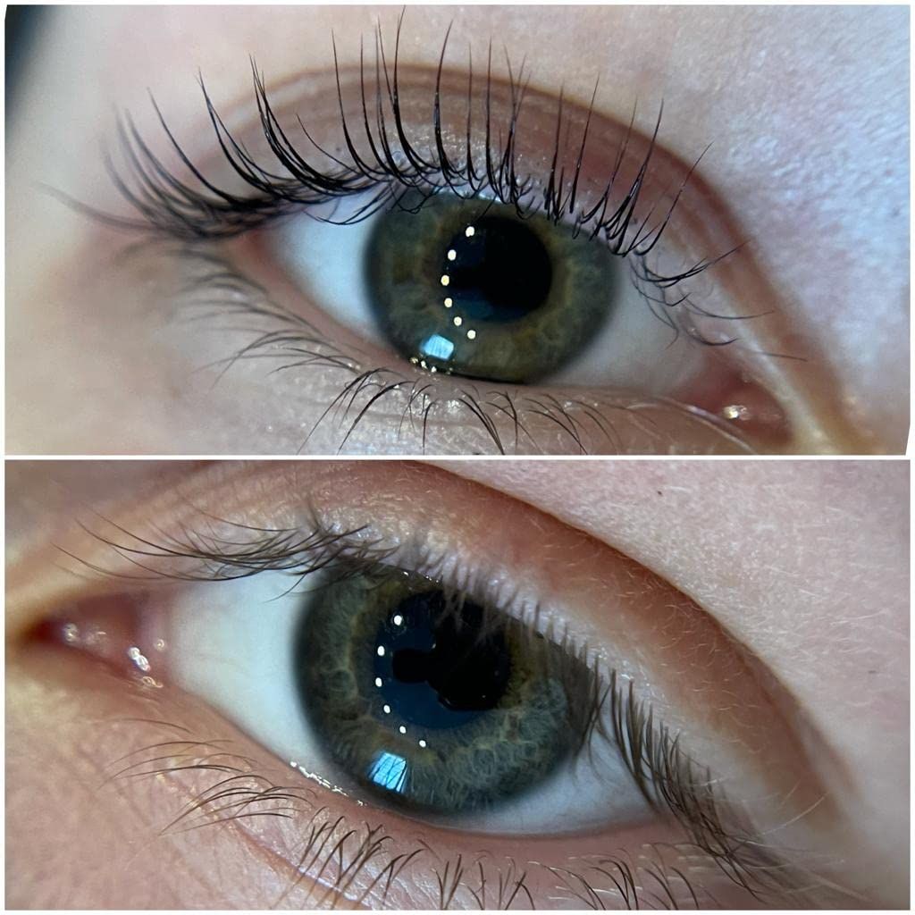 Customer photo review of LASH BOOSTER - 4ML
