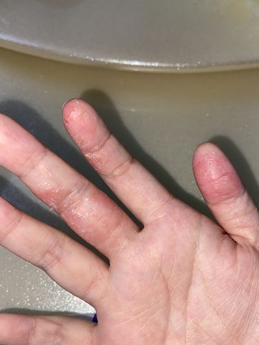 Customer photo review of Jolicare Cream