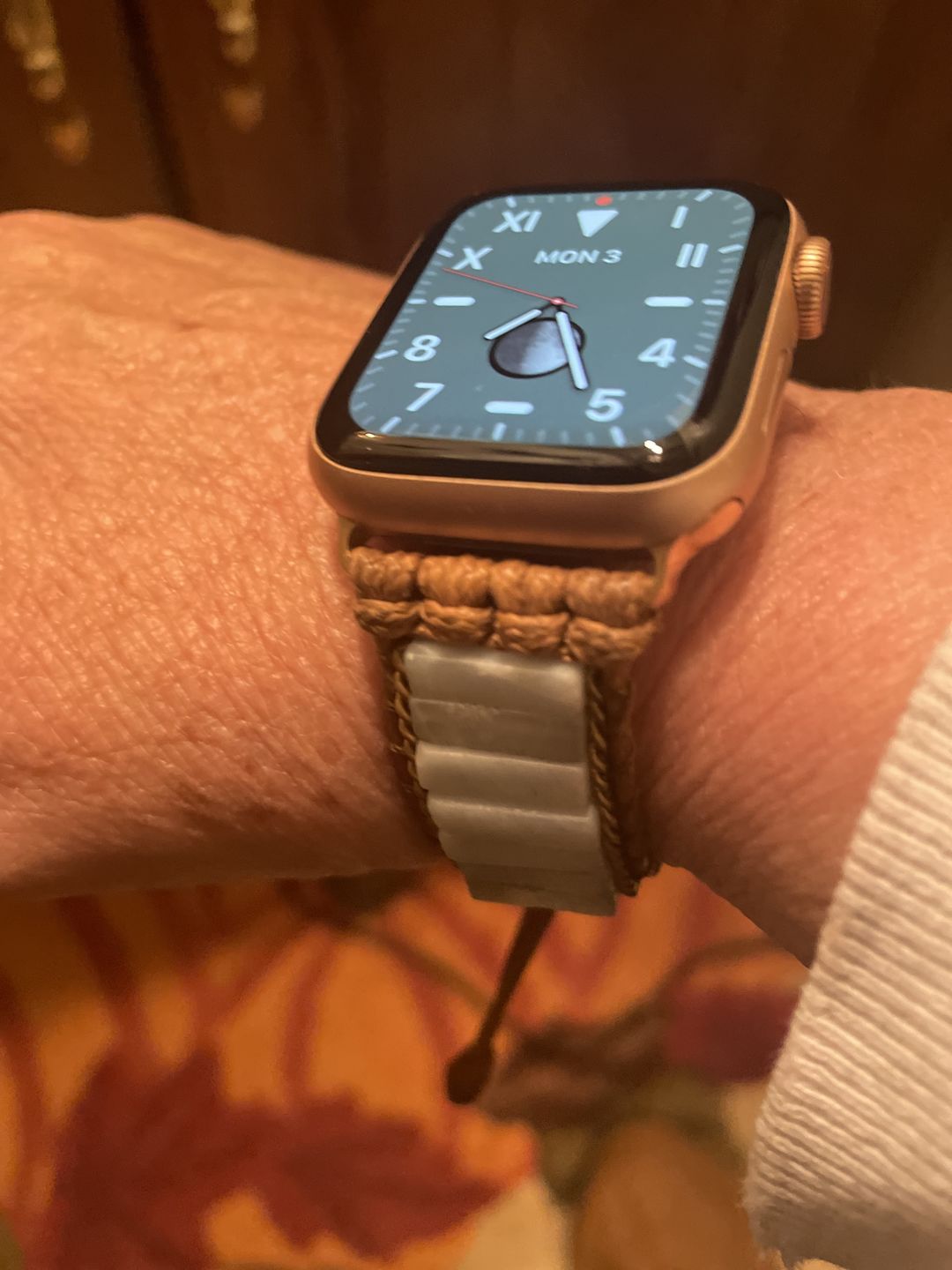 Customer photo review of Amazonite Protection Apple Watch Strap