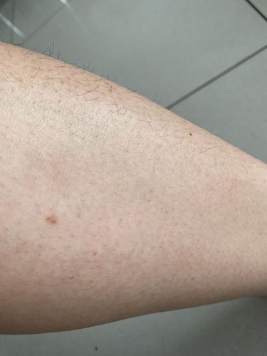 Customer photo review of Depilador Nuva Skin®